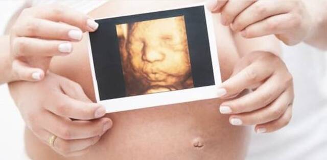 Latido fetal: ¿cuándo se escucha el latido del bebé?